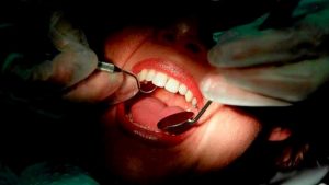 More Hume raids on sub-standard dental clinics