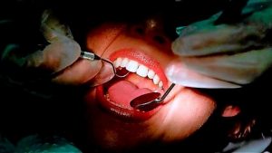Unregistered dentists in the north