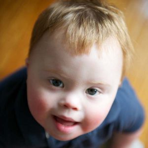 Life and love with a  down syndrome child
