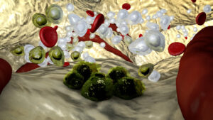 Government funds new first-line treatment for deadly blood cancer